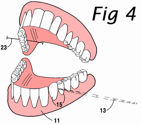 patent drawing