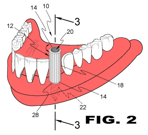 patent drawing