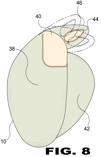 patent drawing